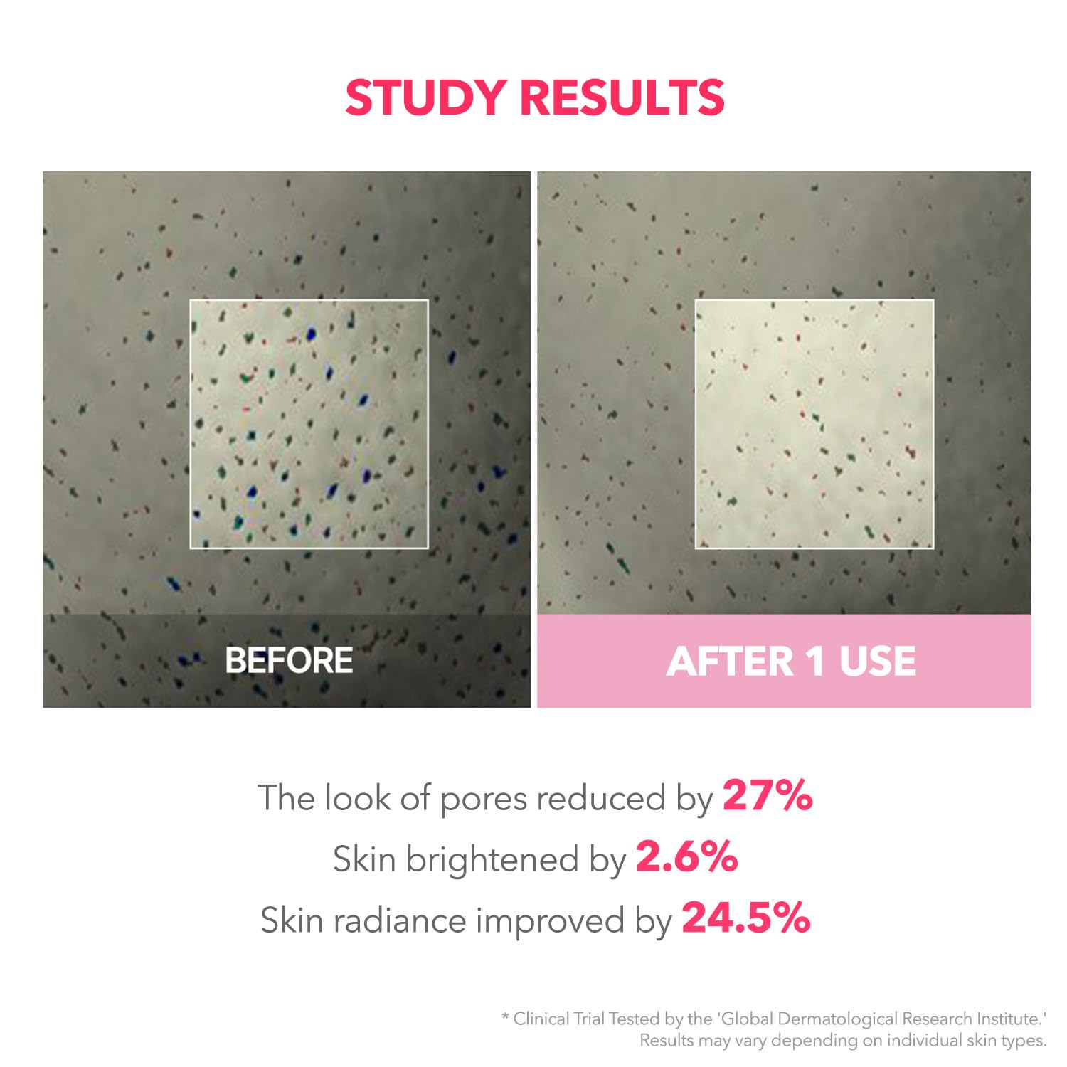 APRILSKIN TXA Niacinamide 99 Night Wrapping Mask