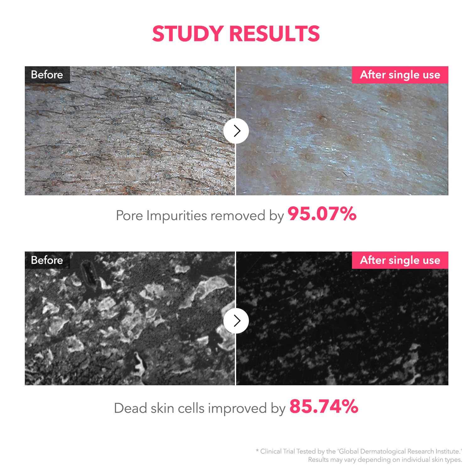 APRILSKIN TXA Niacinamide 99 Deep Cleanser