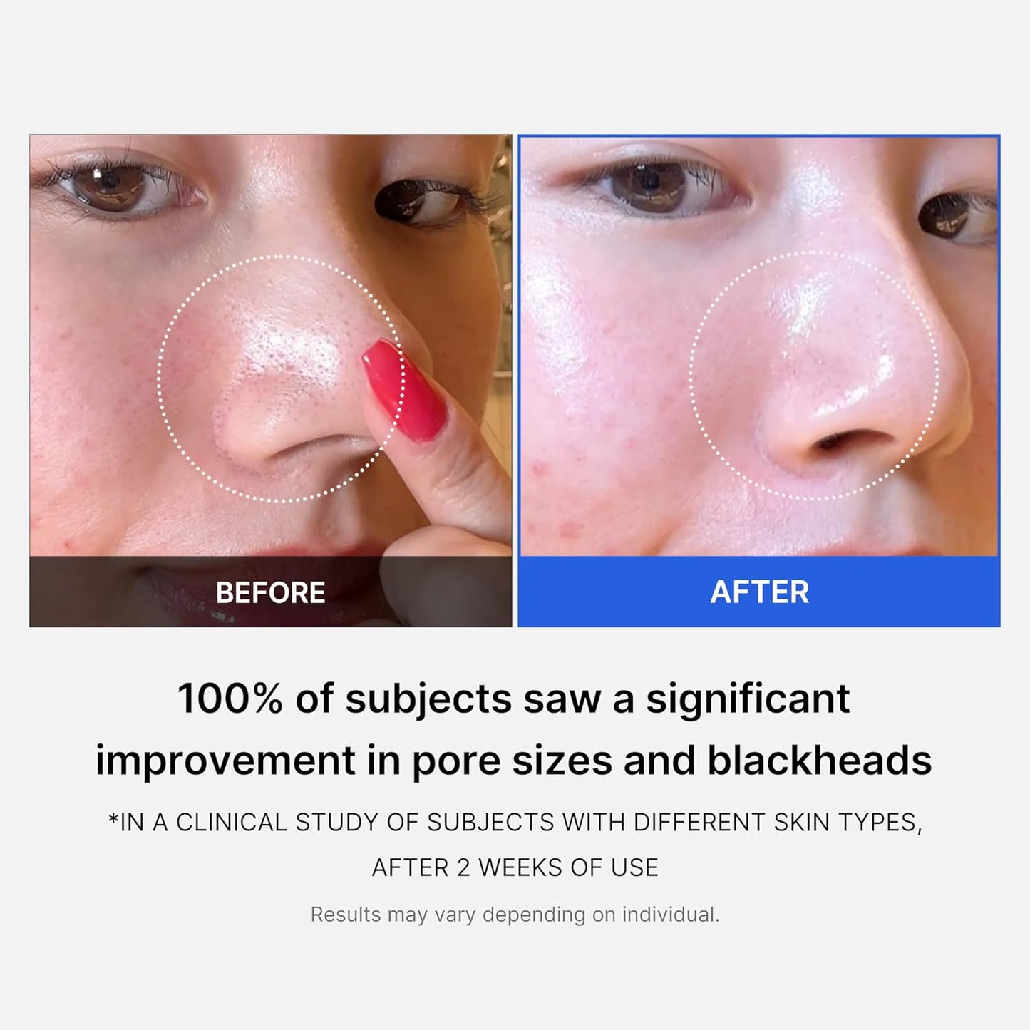 Medicube Zero Pore Pad 2.0