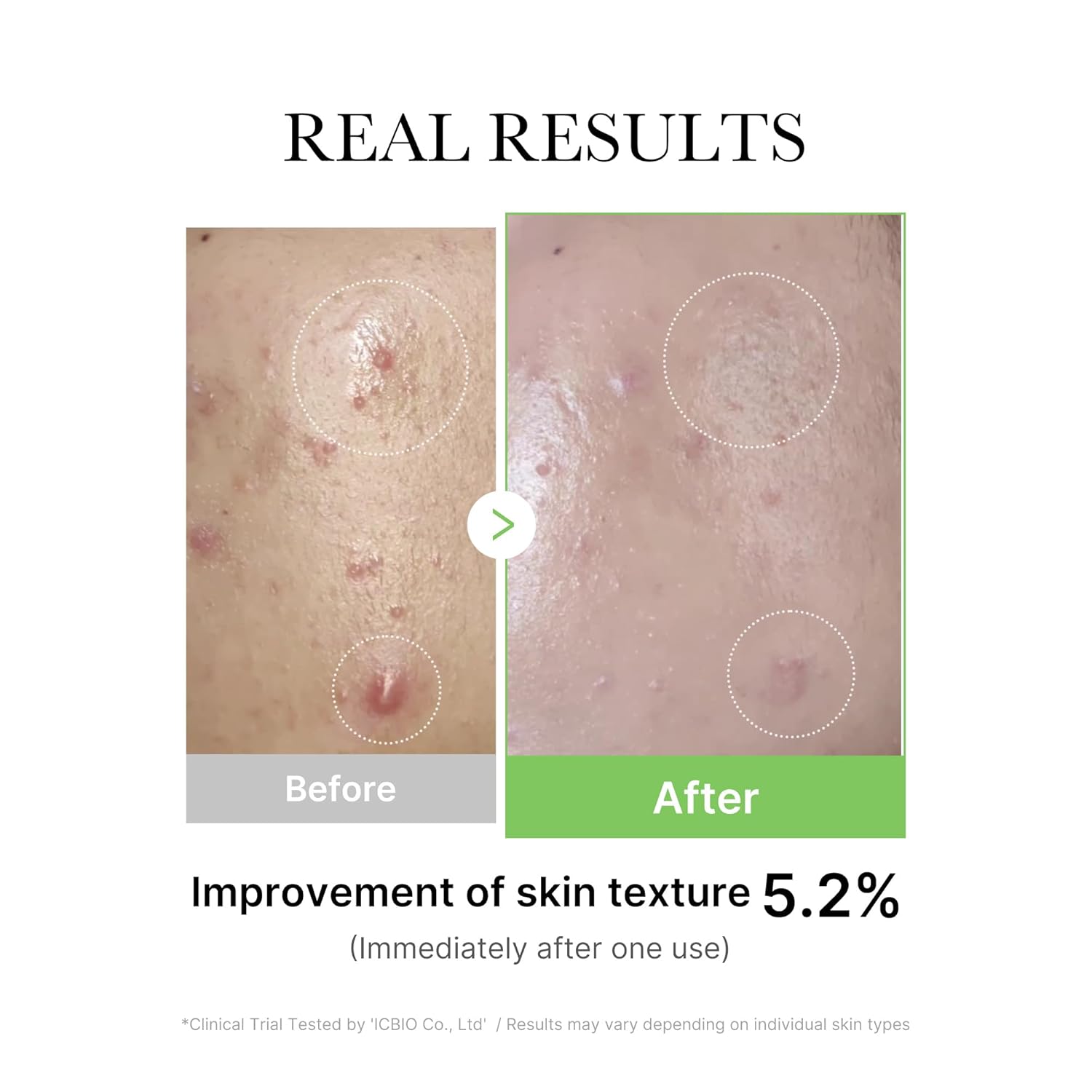 Medicube Exosome Cica Ampoule