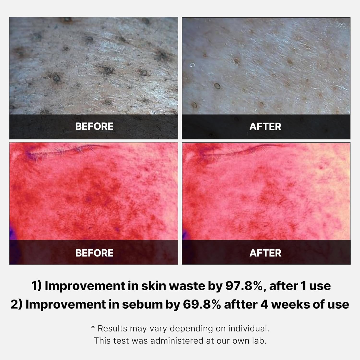 Medicube Red Succinic Acid Peeling Pad