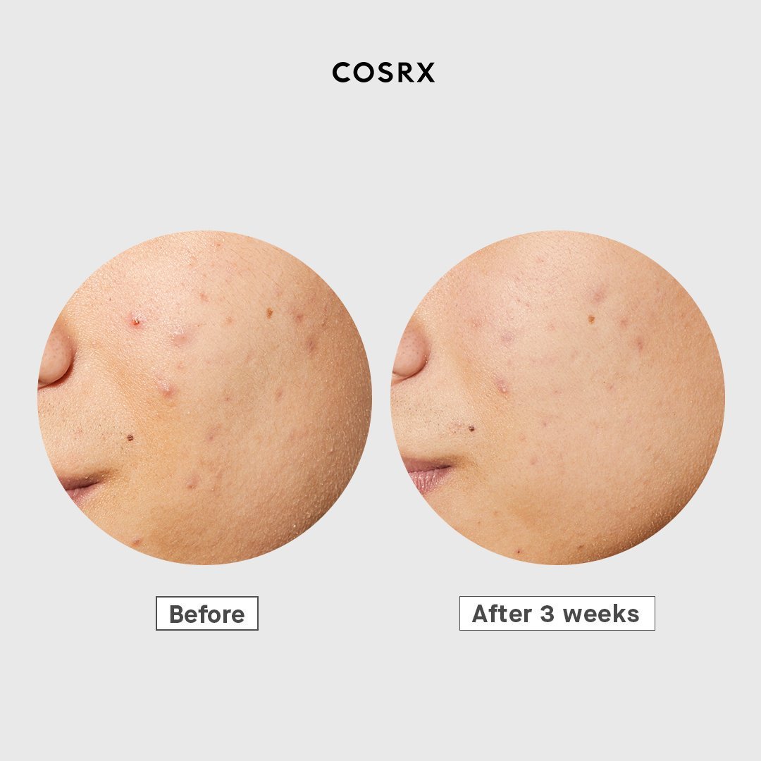 COSRX AC Collection Ultimate Spot Cream