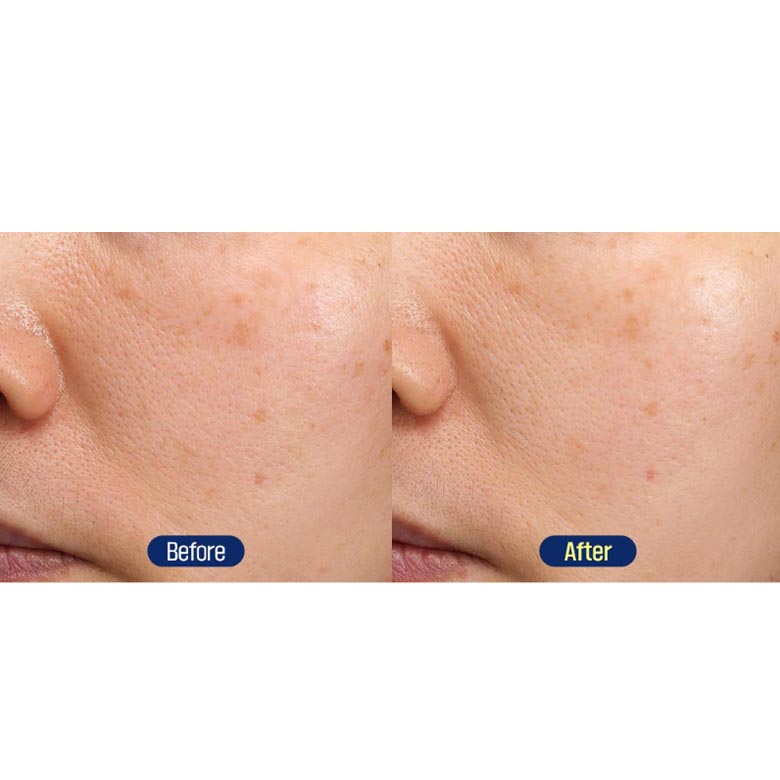 FATION Mela Zero Dark Spot Toning Cream
