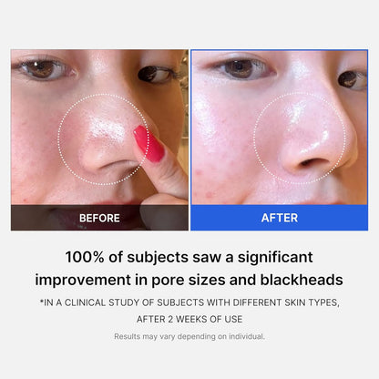 Medicube Zero Pore Pad 2.0