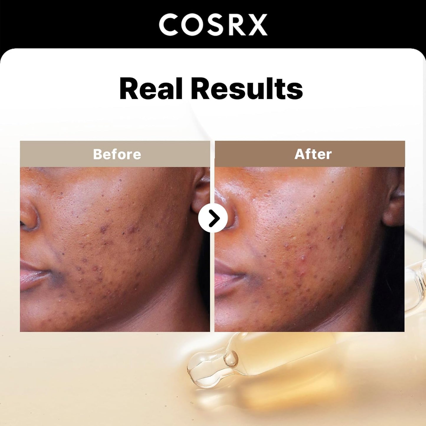 COSRX The Alpha-Arbutin 2 Discoloration Care Serum