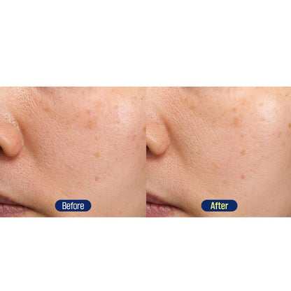 FATION Mela Zero Dark Spot Toning Cream