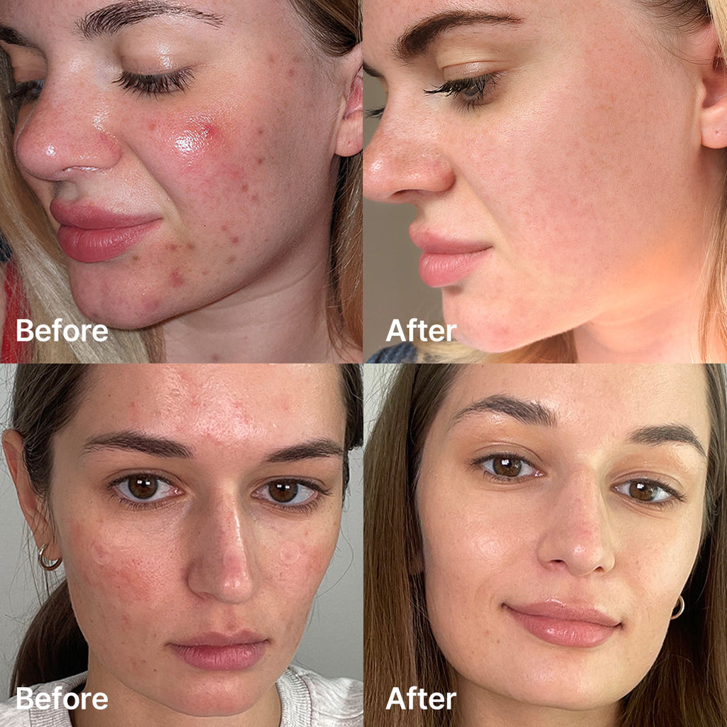 Medicube Red Succinic Acid Serum