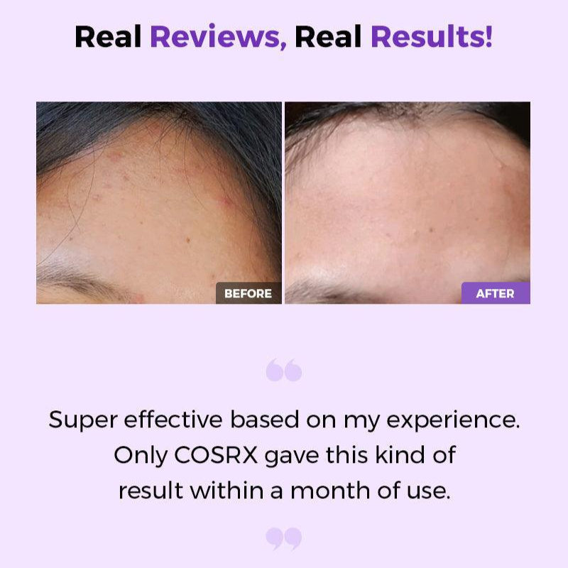 COSRX AHA/BHA Clarifying Treatment Toner