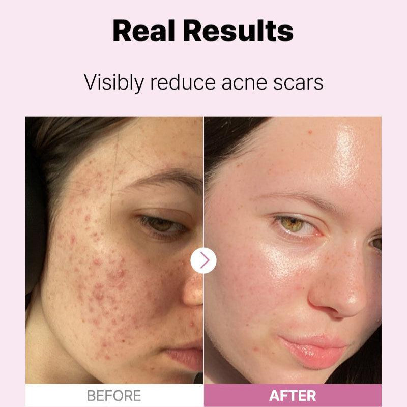 COSRX The Niacinamide 15 Serum